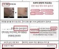마이크로니들 화장품 ‘허위·과대광고’ 82건 적발